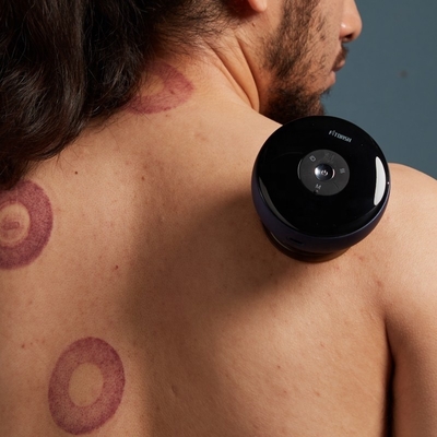 ABS PC Fitdash Massageur électrique à cupping avec aspiration sous vide et vibration électronique