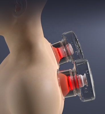Prise en charge de l'OEM/ODM Smart Cupping Therapy Massageur Appareil de coupe sous vide Coupe rechargeable