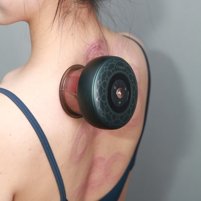Taille du produit 94*94*72mm Fitdash Dispositif Moxa multifonctionnel de coupe de massage de thérapie du corps