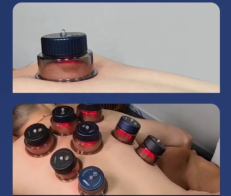 Coupe de respiration intelligente avec une résistance à l'aspiration de -10 kPa à 60 kPa et une coupe de 3,7 V/150 mAh