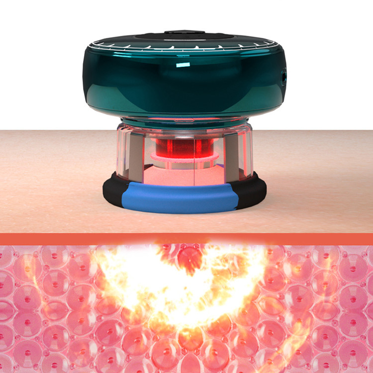 Fitdash TENS Smart Vacuum Copper Chargeable et facile à utiliser pour améliorer la circulation sanguine